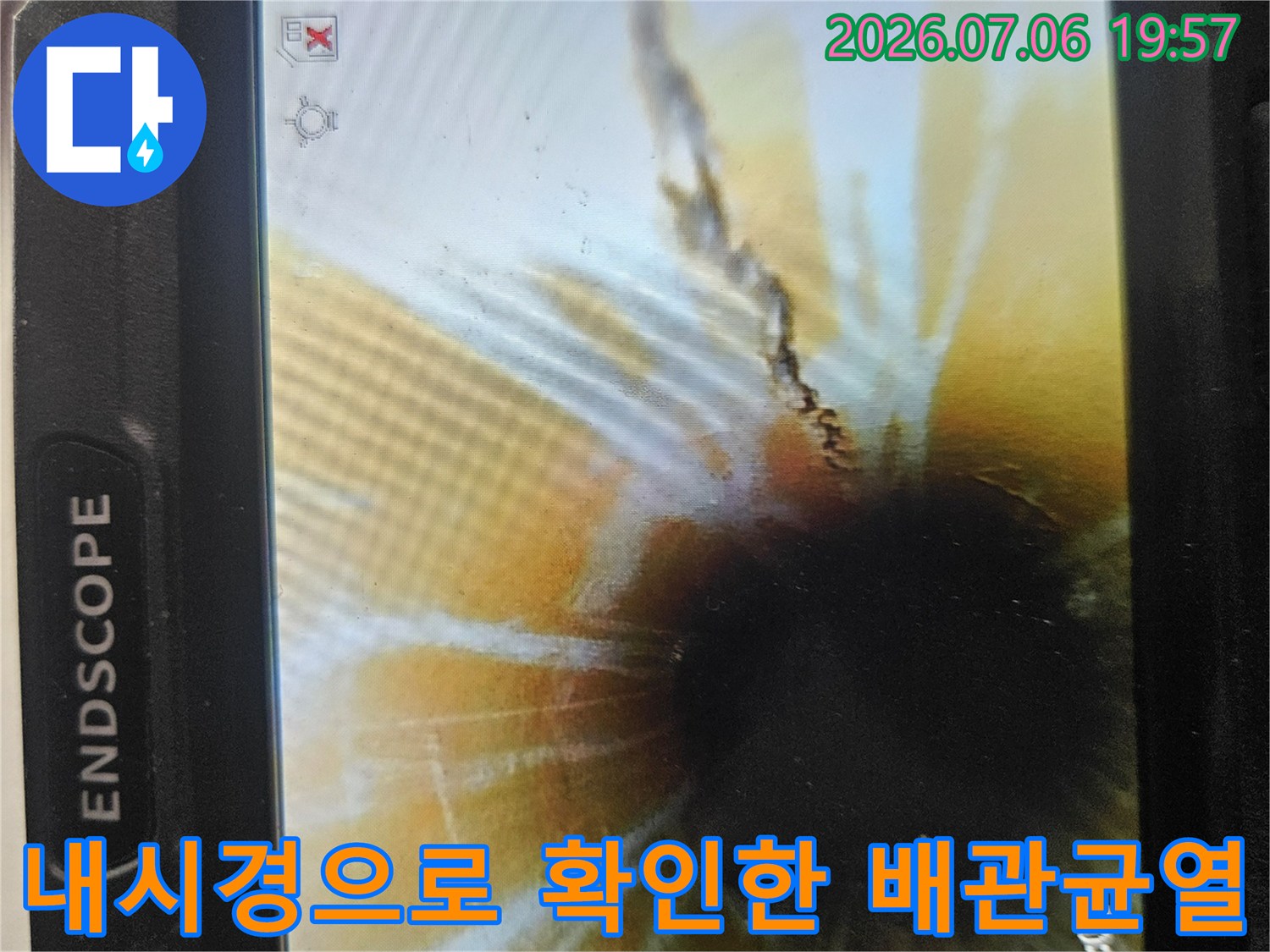 내시경 카메라를 통해 촬영된 배관 내부의 균열과 파손 부위